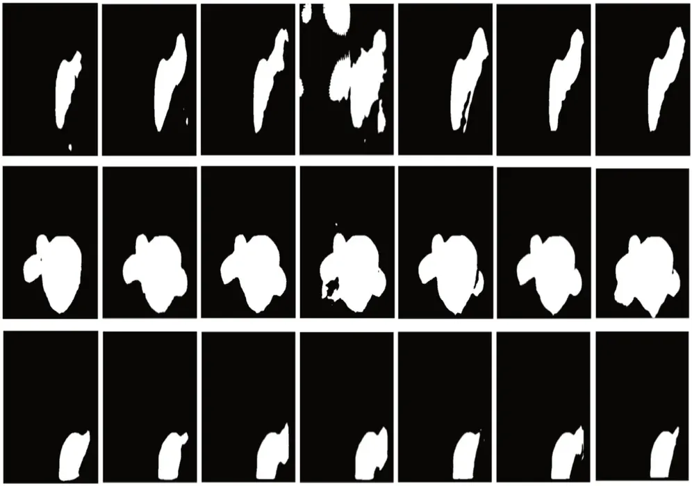 Figure 3 from “Flexible Dilated Convolution and Bidirectional Pyramid Approach to Polyp Segmentation”